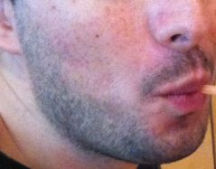 beard 1 week close up