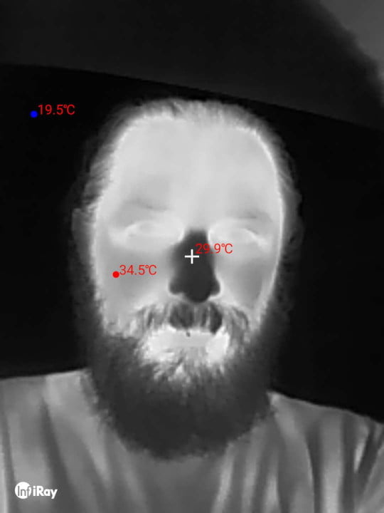 Black and white thermal photo of my face. My nose is black because it is so cold.