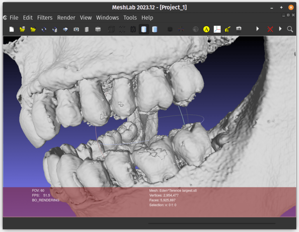 Meshlab showing a close up of my teeth - there are some weird lumps.