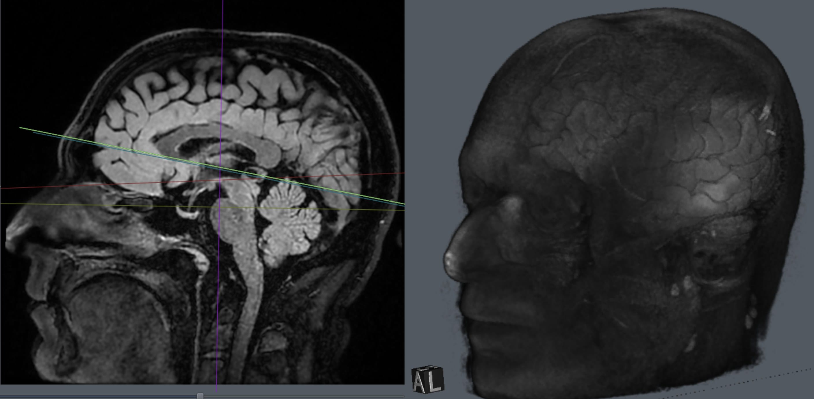 Slice of my head next to a 3D representation.